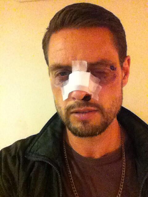 KEITH DUFFY Twitter: "I must of had a great night I can't remember a http://t.co/Ras0jIurAX" /