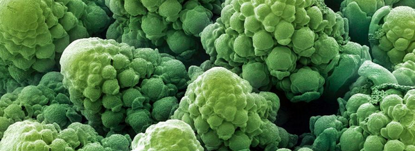 elconfidencial's tweet photo. ¿Sois capaces de reconocer estos 24 objetos cotidianos bajo el microscopio? http://t.co/EQdLli3CYu http://t.co/3IFUMeZ6N1