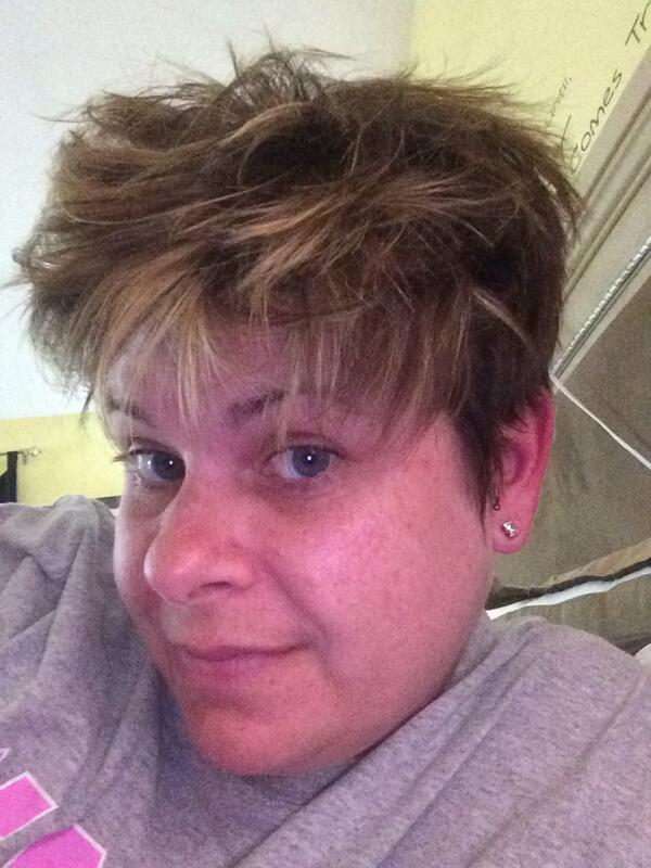 Sunburn or #tecfidera flushing? You be the judge. #mssucks