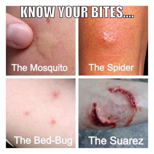 Dannyreid1978's tweet photo. Know you're bites! http://t.co/57t4Rir3Av