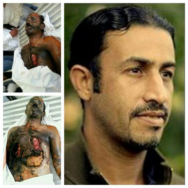qaherathalmain's tweet photo. قصة القائد الميداني #شهيدنا_حسين_عبدالكريم الذي إغتيال على يد عصابة آل خليفة المجرمين #البحرين
http://t.co/1bR1DKW6QH http://t.co/fpN2gDs1jR