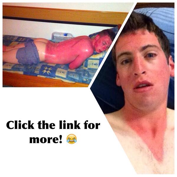 TheeOutdoorLife's tweet photo. 15 FUCKED UP sunburns that will make you laugh!

-----> http://t.co/7tFbUwgOiw <----- http://t.co/6CIM4ncPD7