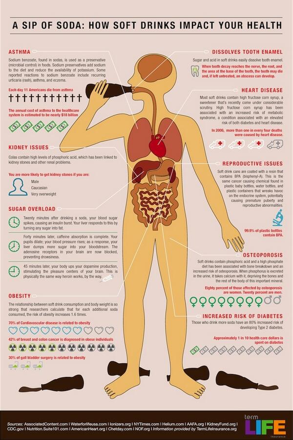 DesignDentalSpa's tweet photo. Why you should cut back on soft drinks! - #Brushyourteeth #Dentist #Tips #Health #Overallhealth #softdrinks http://t.co/44Jec69reC