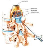 Don't leap straight to surgery. Check out #minimallyinvasiveprocedures. #pain buff.ly/1v1qwpf