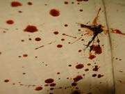 ForensicAccess's tweet image. #bloodpatternanalysis this powerful #forensic technique can be used across #crime types: forensic-access.co.uk/blood-pattern-…