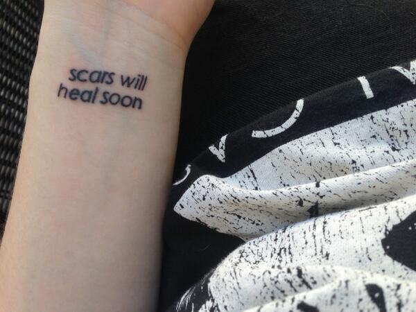 PhillMeain's tweet image. Scars will heal soon