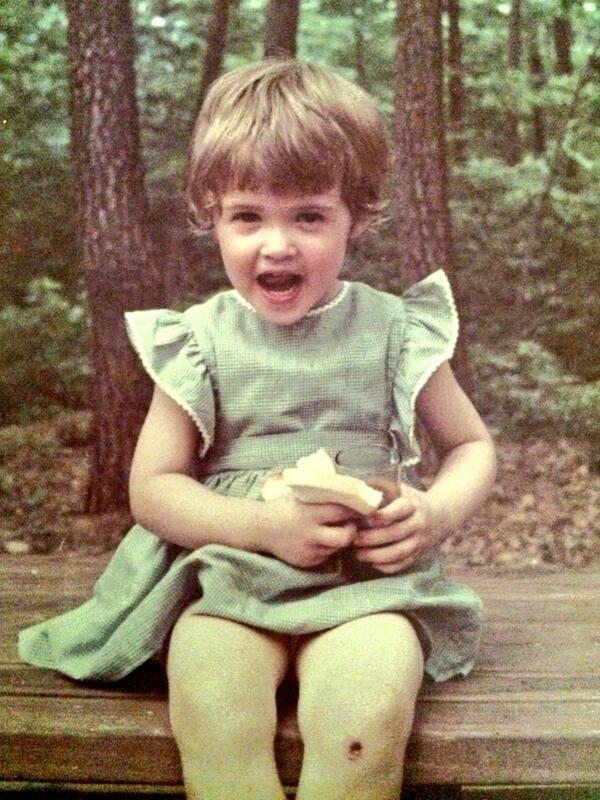 Skinned knee + a big-ass smile = childhood. #tbt Skinned knee + a big-ass smile = childhood. #tbt