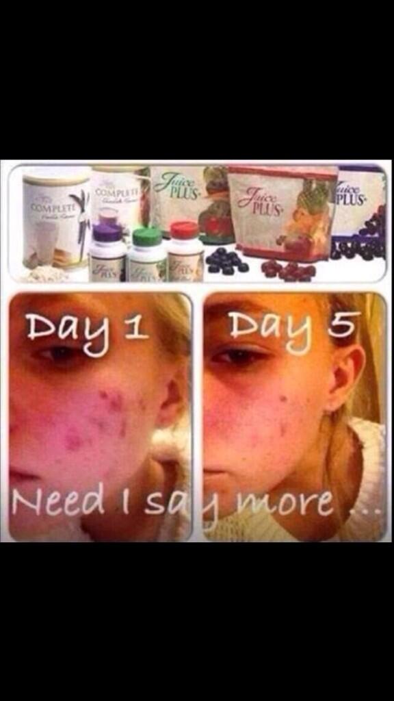 juicePlusRachx's tweet photo. Juice plus helps skin hair and nails aswell as weihhtloss!!! Placing orders 🍋🍌🍅🍐🍍🍒🍓🍇🍉 http://t.co/Ano46iAYAo