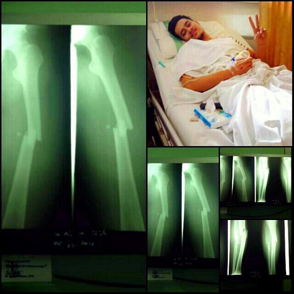 Mdnghtcornering's tweet photo. Gws for ali @ConanBandung  semoga lekas sembuh.... http://t.co/uohMnpzW6B