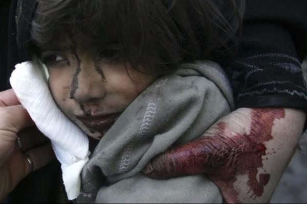 KadirTunaSoylu's tweet photo. Filistin'de çocuk olmak..
Yıkılan binaların kıyısında, parçalanmış cesetler arasında ölüm korkusu ile yaşamak.. http://t.co/4AVfiKWLaa