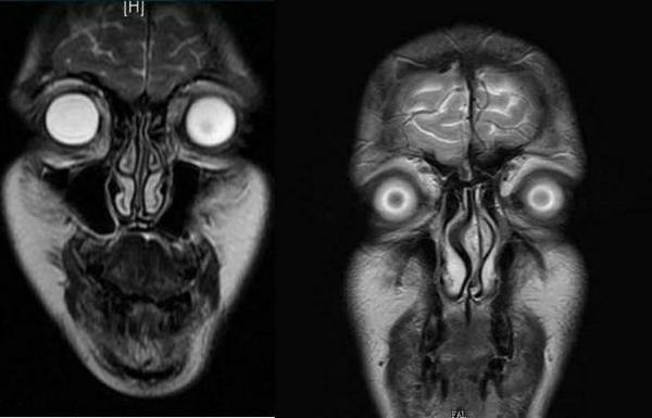 terrifyingposts's tweet image. MRI scan of the human head.