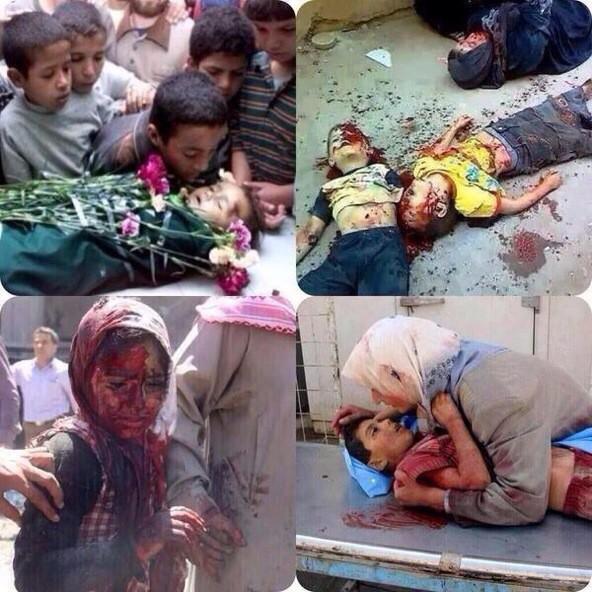 melekcanbaksi's tweet photo. Ölen insanlar mıydı ?? Ben ölen bir insanlık görüyorum 😞😞
#DirenRojava #DirenGazze 😞 http://t.co/7Lhpg15oAk