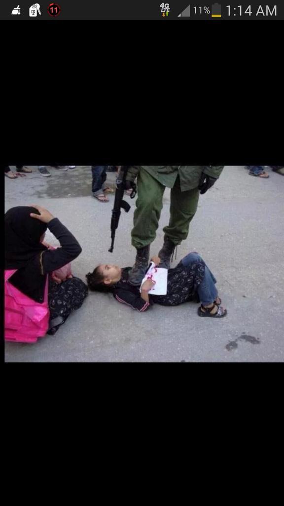 ToghralBalkhi's tweet image. Reverse holocaust , humans disgusts me #FreePalestine #freehumans