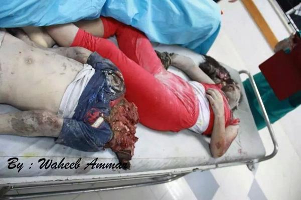 raniayazgi's tweet photo. لم اعتذر على بشاعة الصور لان الحقيقة اسوء بكثير ..اللهم إنا نستودعك #غزة يا من لا تضيع عنده الودائع
 #غزة_تحت_القصف http://t.co/TJvi8vZxD3