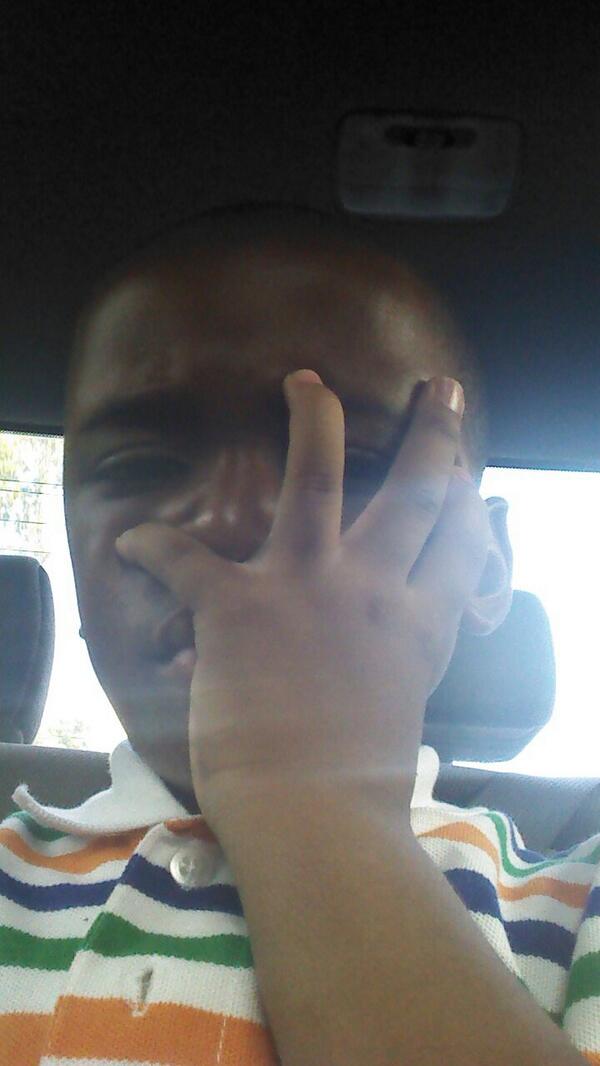 john_akarn1908's tweet photo. My eye hurts alot http://t.co/Z3fzVJlWT0