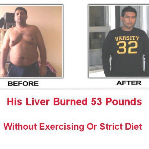 GallbladderSymp's tweet photo. Did You Know Your Liver Is The Most Powerful FAT BURNER?. Turn The SWITCH - Detox The Liver: http://t.co/p2lYCCVa9m http://t.co/NpQmOYp84b