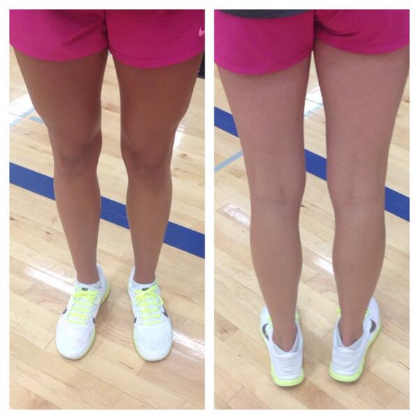 lexpickett_'s tweet image. Ally really needs to learn to flip over!! #SamePerson #SameLighting #DifferentColor 😂😂😂