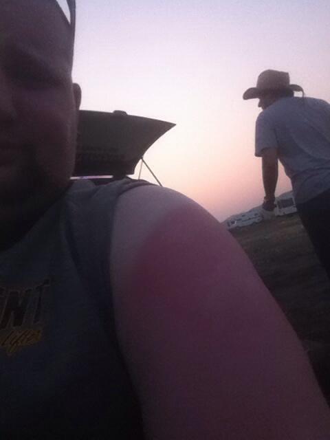 woodhead322's tweet photo. Sunburnt just from driving here only on my left arm!! #craven2014 http://t.co/l3PytVMSWV