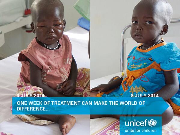A week of care can mean a world of difference. Thanks to @UNICEFSsudan for the story: uni.cf/1sjNdIt