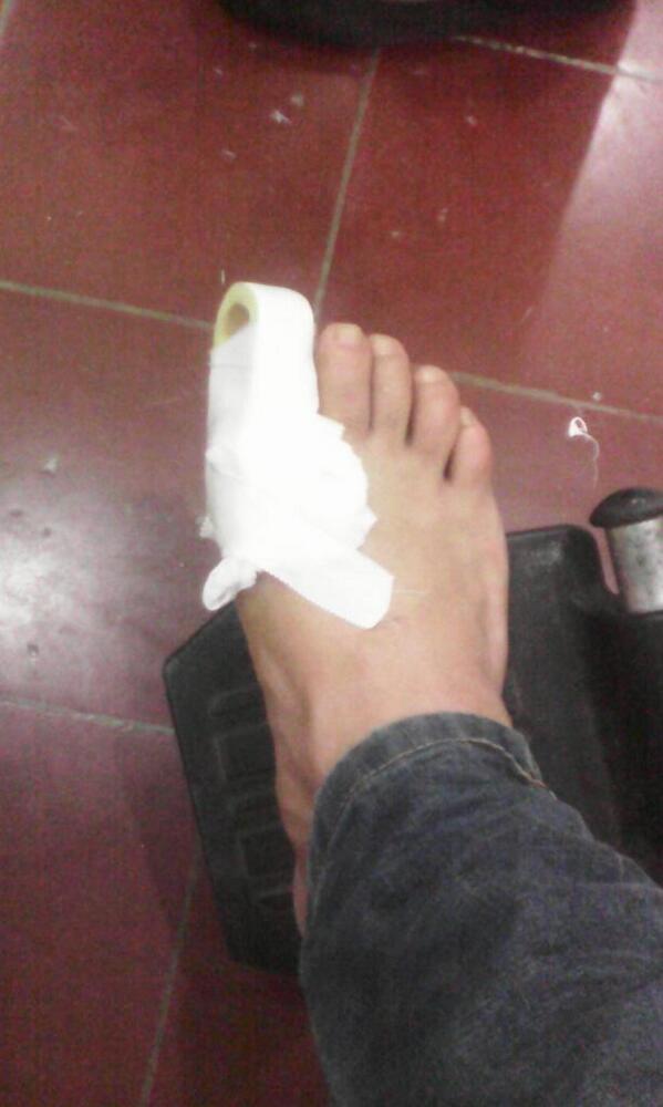 adalagui15's tweet photo. Awww amiga mira como estoy me fracture el dedi http://t.co/8qlRwwAwPU