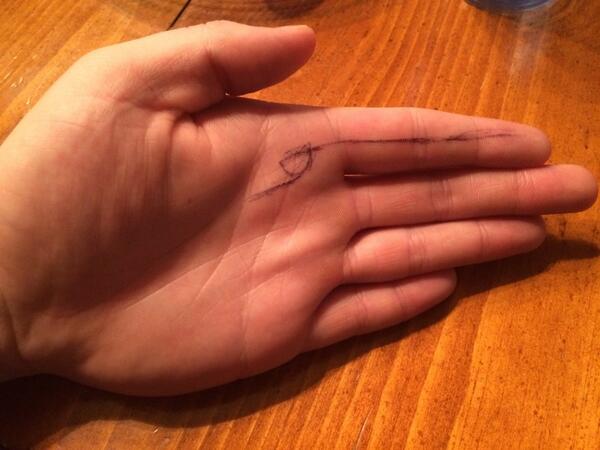 Cheeriebomb's tweet image. I got a cut on my finger. #JustEditorThings