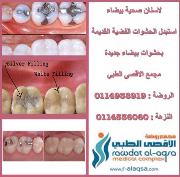 aqsaclinics's tweet photo. لاسنان صحية بيضاء
استبدل الحشوات الفضية القديمة
مجمع الاقصى الطبي
الروضة : 0114938919 
 النزهة : 0114536060 http://t.co/Z9uWp1d8hM