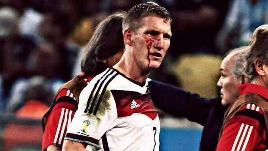 kingdavide's tweet photo. Do The Unthinkable: I shed blood for my country, can you???? #GermanHero..!!!! #GER http://t.co/anUnObV4BQ"