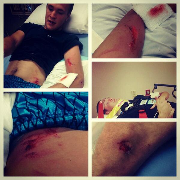 whyamihere2332's tweet photo. Scariest moment of my life! #hitbyatruck #roadrash #bmx #biketoasted #lucky #retardeddrivers #redlights #noturnonred http://t.co/SEuKtMd1EF
