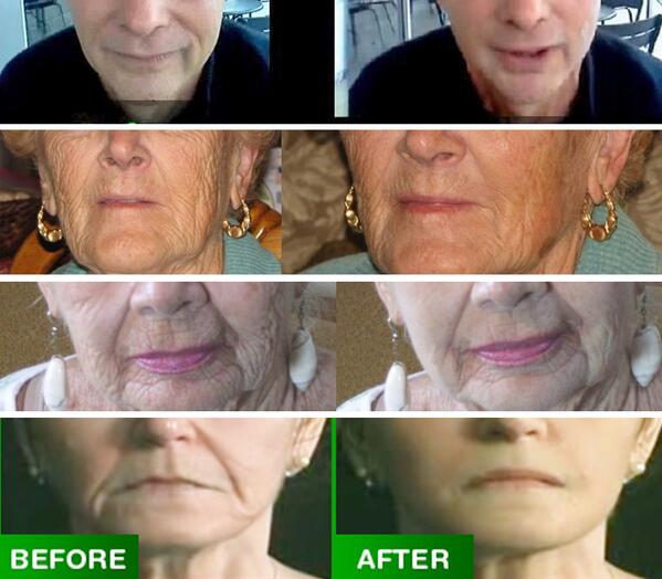 GetSublimeLift's tweet image. Americans now spend more than $1 billion a year on anti-aging skin products ... get the facts! tinyurl.com/krl9e3c