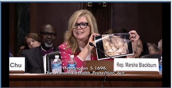 LifeNewsToo's tweet image. Pro-Life Congresswoman Shows Ultrasound of Her Grandson to Oppose Radical Abortion Bill 
bit.ly/Wfinnt #tcot