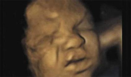 StevenErtelt's tweet image. Abortion Clinic’s Advertisement Tells Women: We “Gently” Remove “Tissue” bit.ly/WfebE3 #protectlife #tcot