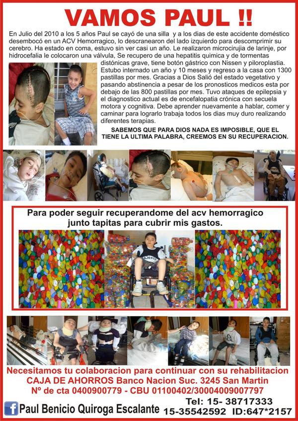 AYUDAparaPAUL's tweet photo. Por favor RT. Necesito OPERARME URGENTE. Junto tapitas y recibo donaciones. Mas info https://t.co/sD7sZxKR0f Gracias http://t.co/AsmO8nqNbT