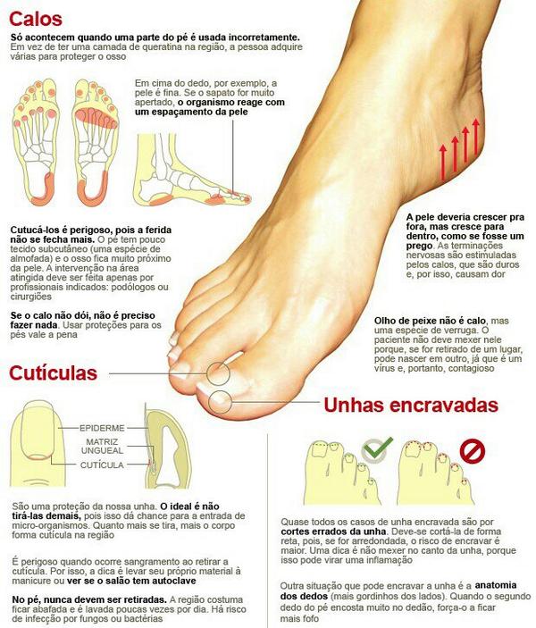 Calo Olho De Peixe No Dedo Do Pé - Olho Relacionado