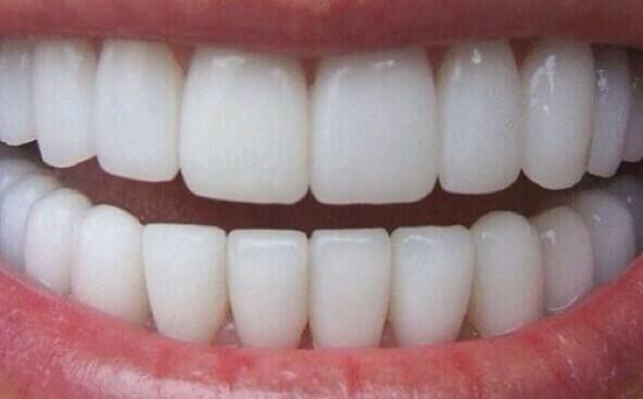 If i had this set of teeth i wouldnt even bother talking i'd just smile until i die: