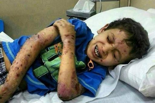 Helpp_you's tweet photo. مرض نادر يفتك بجسد طفل بــ #حفر_الباطن 
http://t.co/brtK1FpKUQ

#الطفل_تركي_يناشد_اهل_الخير
#الطفل_تركي_عشوي_العنزي http://t.co/bSthqDlSTm