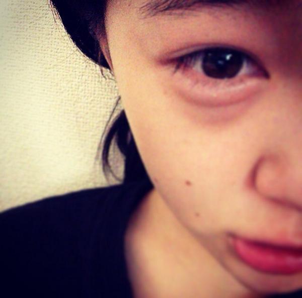 Little Glee Monster 目から沢山の水が流れ出てきて 止めたいのに止まらなかった 凄く涙袋が腫れ上がってこんなに 腫れたの始めてだから自分でも 凄く引いてる せりな Http T Co Ckqnd4nkfm