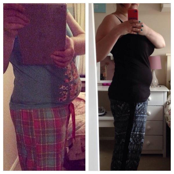 Char_Johnson13's tweet photo. #weightloss no more #pred no more #largebowel getting my figure back after years of shitty #crohns #colitis #ibd http://t.co/mx1pKSQXQc