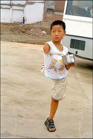 человек с половиной тела кенни истердей. пиях мартелл с мужем. педро мартелл пол тела. педро и эндрю. половина человека как живут.