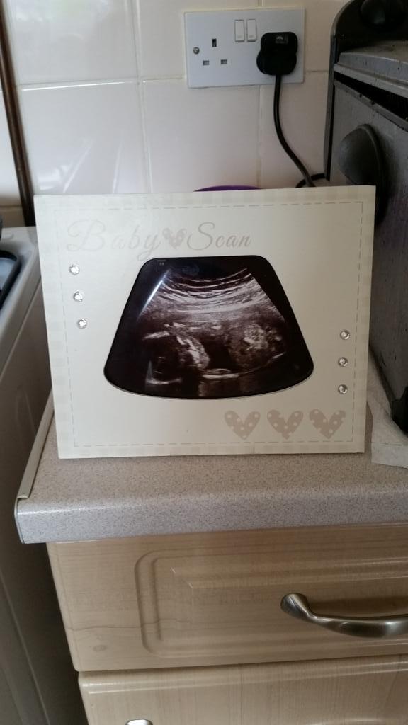 MrsOmCfC's tweet photo. Mine &amp; ste little baba due 13.12.14...... i am over the moon.... never say never!! http://t.co/jAHK0ApqU7