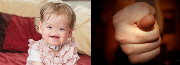 looping2k's tweet photo. Tessa, 17 mois, ne pourra jamais jouer à 
"J't'ai volé ton nez !!"
http://t.co/UVzrsxtdrz http://t.co/JTn3kfm8Fs