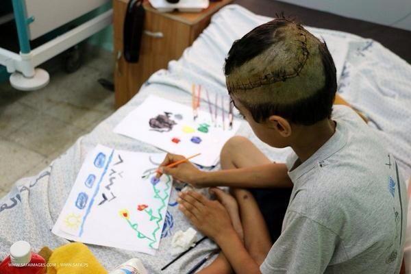 LebaneseProblem's tweet photo. An injured Palestinian kid draws his dream; Flying Birds not rockets,blue sky...Peaceful view. He drew peace on earth http://t.co/j8ROR9VCTZ