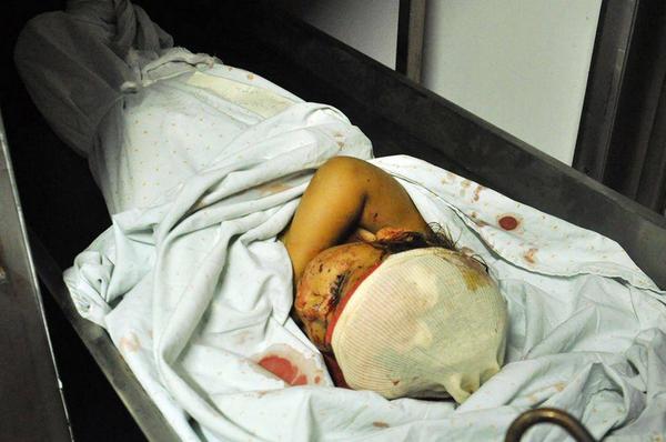 umeer_elias's tweet image. @AIPAC #WTF #IDFF what the hill, do something better, 80% of your targets up to now children #gaza #GazaUnderAttack