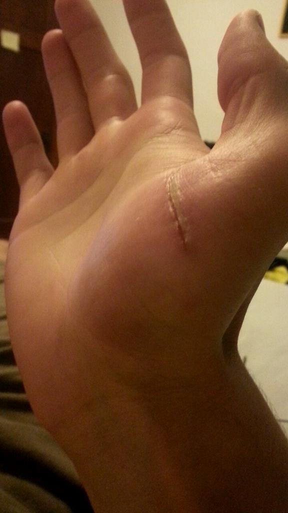 BoxingAnon's tweet image. This is what @wheezingrunner 's cat did to me last night. #evil #fbimostwanted #shelies