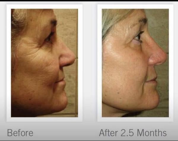 klasha66's tweet image. #crowsfeet #agingproblems #antiaging #wrinklesolution #answertoyourwrinkles #skinsolutions kkagawa.myrandf.biz