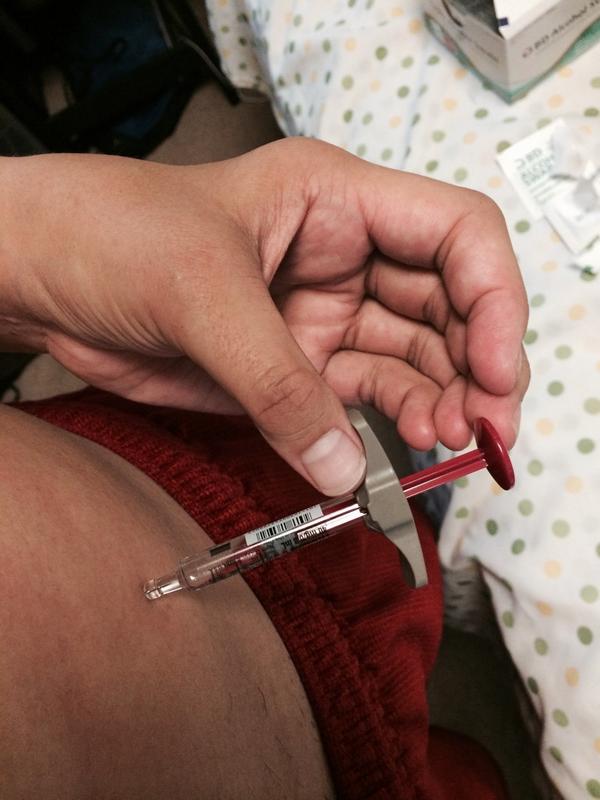 TherealDalle's tweet image. 5 months doing this and still not used to it #EffYouArthritis #IHateMeds #CanIBePainFreePlease