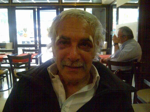 fernandogalmar1's tweet photo. Estoy bien,ahora me encuentro en misiones me quedan los rastros del golpe. Gracias y un abrazo a todos. http://t.co/GFMk8DLUHE