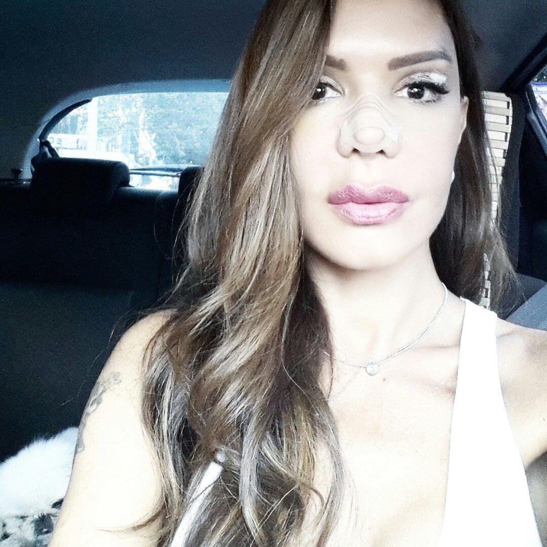 Sevda Demirel On Twitter G Z Mde Bandaj Yok Art K Ok Sukur T 18720 | Hot Sex  Picture