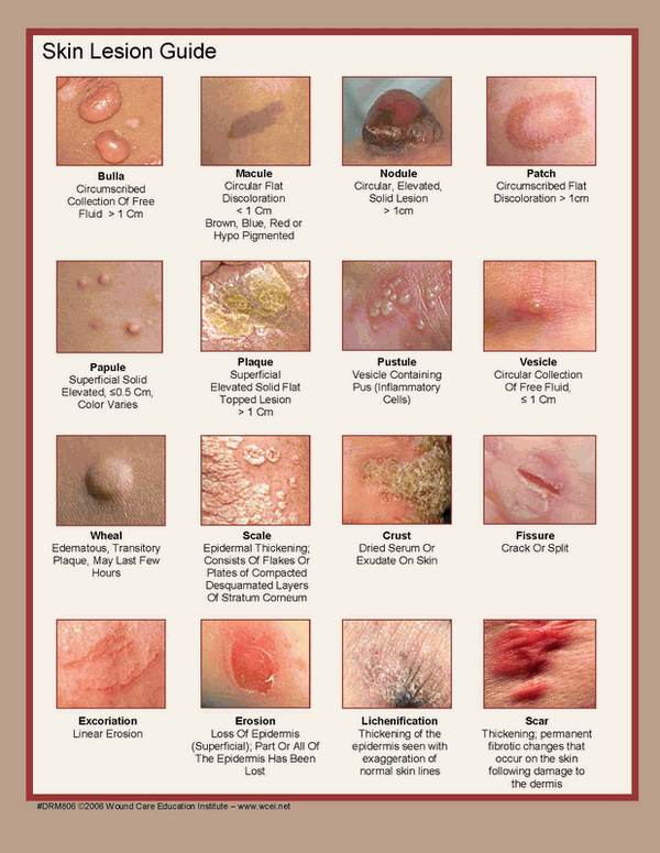 dermatological descriptions