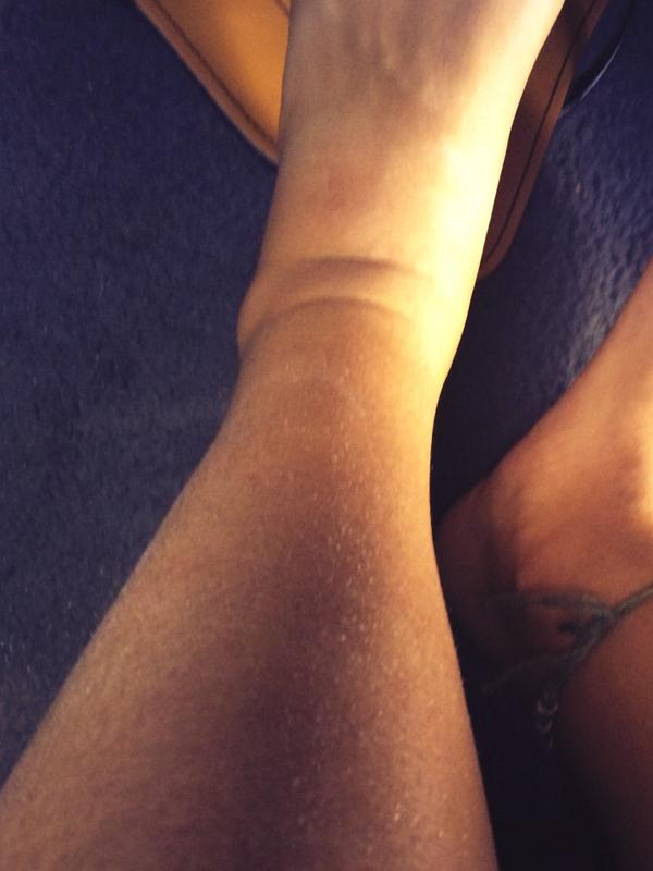 LyndseyKnowles's tweet image. Kankle orrrrr.... #sprained 😂😂😂