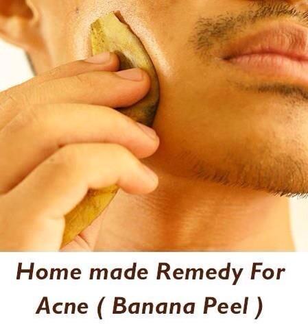 ModDayHippiebox's tweet image. missclinic.net/2013/08/5-natu… #MustTry #GreenModel  banana anyone!?